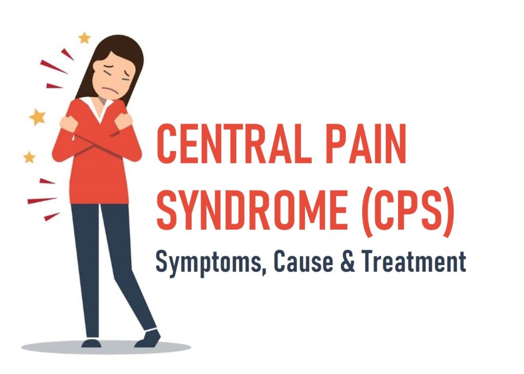 Central Pain Syndrome (CPS) | Symptoms, Causes & Treatments