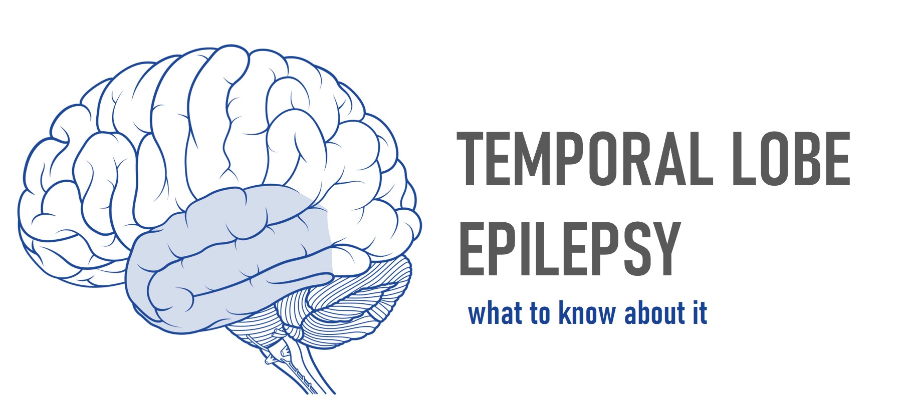 Temporal Lobe Epilepsy What To Know About It